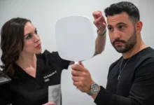Hair Transplant Chicago