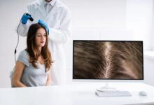 Exosome Treatment for Hair Loss​