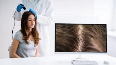 Exosome Treatment for Hair Loss