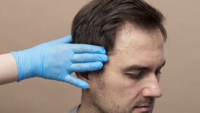 Hair Transplant in Kolkata