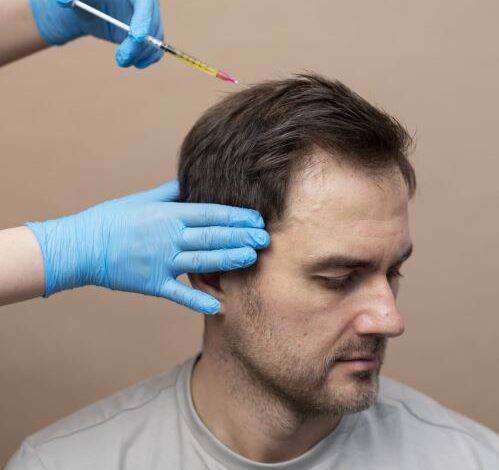 Hair Transplant in Kolkata