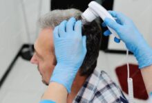 Exosome Hair Therapy in Kolkata