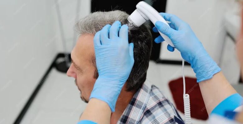 Exosome Hair Therapy in Kolkata