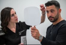 FUE hair transplant near me