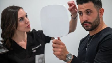 FUE hair transplant near me