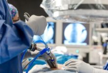 best spine surgeon south india