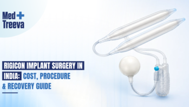 Rigicon Implant Surgery in India